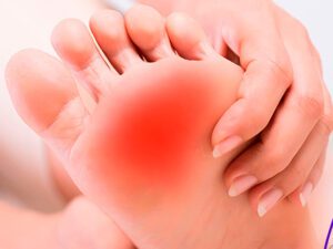 Metatarsalgia - Clinica del campestre