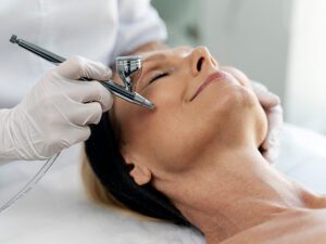 microdermoabrasión - Clinica del campestre