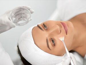 peeling quimico - Clinica del campestre
