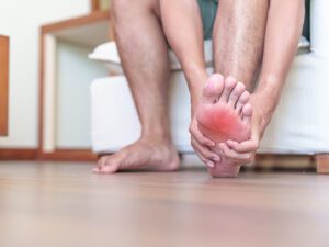 Solución definitiva para los callos en los pies - Clinica del campestre