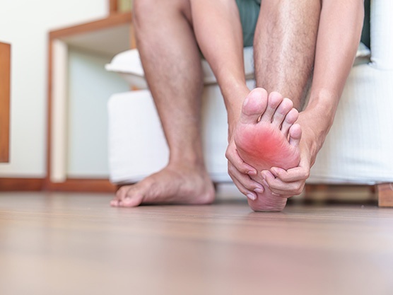 Solución definitiva para los callos en los pies - Clinica del campestre